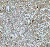 IHC staining of FFPE rat brain tissue with Growth Hormone antibody. HIER: boil tissue sections in pH8 EDTA for 20 min and allow to cool before testing.