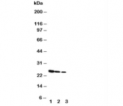 Western blot testing of Growth Hormone antibody and Lane 1:  Recombinant rat GH protein 10ng;  2: 5ng;  3: 2.5ng