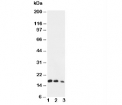 Western blot testing of IL7 antibody and Lane 1:  Recombinant human IL-7 protein 10ng;  2: 5ng;  3: 2.5ng