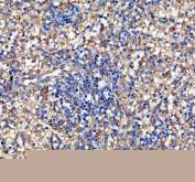 IHC staining of FFPE human spleen tissue with human IL-10 antibody, HRP-labeled secondary and DAB substrate. HIER: boil tissue sections in pH8 EDTA for 20 min and allow to cool before testing.