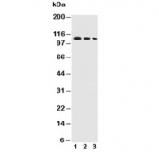 Western blot testing of CEACAM5 antibody and recombinant human protein at 1. 5ng,  2. 2.5ng, 3. 1.25ng