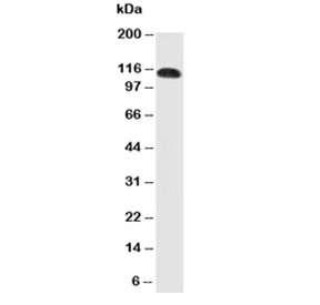 Western blot testing of CEACAM5 antibody and SW620 cell lysate. The glycoprotein is routinely visualized by western blot at 80~120KD.~
