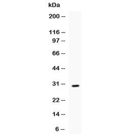 Western blot testing of recombinant mouse IL17 protein (0.5ng/lane) + tag with IL17 antibody at 0.5ug/ml. Predicted molecular weight of native protein: ~17 kDa.