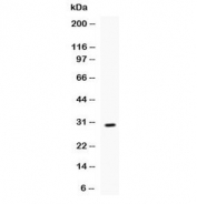 Western blot testing of recombinant mouse IL17 protein (0.5ng/lane) + tag with IL17 antibody at 0.5ug/ml. Predicted molecular weight of native protein: 15-20 kDa (monomer), 30-40 kDa (homodimer), depending on glycosylation level.