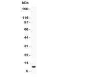 Western blot testing of Prolactin antibody and mouse recombinant protein
