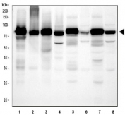 Western blot testing of 1) human placenta, 2) human HCCT, 3) human HCCP, 4) human HepG2, 5) rat liver, 6) rat RH35, 7) mouse liver and 8) mouse HEPA1/6 cell lysate with Transferrin antibody. Predicted molecular weight ~77 kDa.