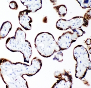 IHC-P: Growth Hormone antibody testing of human placenta tissue
