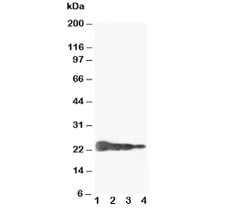 Western blot testing of Growth Hormone antibody and Lane 1: Recombinant human GH protein 10ng; 2: 5ng; 3: 2.5ng; 4: 1.25ng~