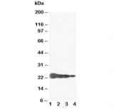 Western blot testing of Growth Hormone antibody and Lane 1:  Recombinant human GH protein 10ng;  2: 5ng;  3: 2.5ng;  4: 1.25ng