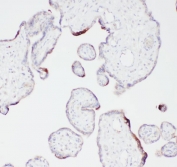 IHC staining of FFPE human placenta with Angiostatin K1-3 antibody. HIER: boil tissue sections in pH6, 10mM citrate buffer, for 20 min and allow to cool before testing.