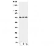 Western blot testing of CD30 antibody and Lane 1:  HeLa;  2: 293T;  3: Jurkat;  Predicted molecular weight: 53-120 kDa depending on glycosylation level.