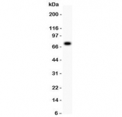 Western blot testing of 5-Lipoxygenase antibody and SGC lysate;  Predicted molecular weight: ~78 kDa.