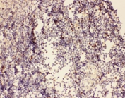 IHC-P: FOXP3 antibody testing of rat spleen tissue
