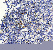IHC staining of FFPE human tonsil tissue with FOXP3 antibody, HRP-labeled secondary and DAB substrate. HIER: boil tissue sections in pH8 EDTA for 20 min and allow to cool before testing.