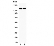 Western blot testing of Collagen III antibody and human cell lysates 1) MCF-4 and 2) COLO320. Predicted molecular weight ~139 kDa.
