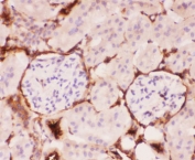 IHC-P: P Glycoprotein antibody testing of mouse kidney tissue