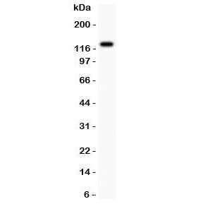 Western blot testing of TIE2 antibody and MCF-7 lysate; Predicted molecular weight: ~126 kDa but may be observable at 130-165 kDa.~