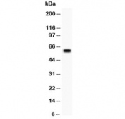 Western blot testing of ATM antibody and recombinant human protein 0.5ng