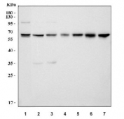 Western blot testing of 1) human HeLa, 2) human 293T, 3) human K562, 4) rat liver, 5) rat pancreas, 6) mouse liver and 7) mouse pancreas tissue lysate with CBS antibody. Predicted molecular weight ~61 kDa.