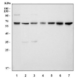 Western blot testing of 1) human HeLa, 2) human 293T, 3) human K562, 4) rat liver, 5) rat pancre