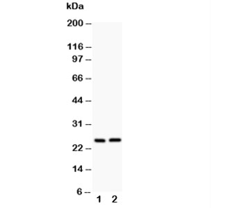 Western blot testing of Claudin 2 antibody and Lane 1: rat kidney; 2: rat liver~