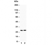Western blot testing of Claudin 2 antibody and Lane 1:  rat kidney;  2: rat liver