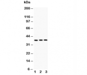 Western blot testing of IL3 antibody and Lane 1:  PC-12;  2: NRK;  3: RH35;  The glycoprotein is routinely visualized between 18~35 kDa.