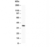 Western blot testing of MBD2 antibody and recombinant human protein 0.5ng