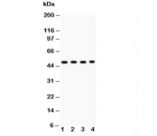 Western blot testing of MBD2 antibody and Lane 1:  SGC;  2: HeLa;  3: Jurkat;  4: K562;  Predicted/observed molecular weight: ~47kDa.