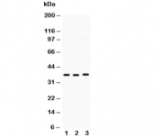 Western blot testing of Midkine antibody and Lane 1:  HeLa;  2: SMMC-7721;  3: SW620;  Predicted size: 16KD;  Observed size: 38KD