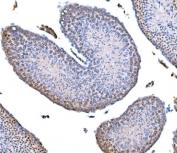IHC staining of FFPE mouse testis tissue with Survivin antibody. HIER: boil tissue sections in pH8 EDTA for 20 min and allow to cool before testing.