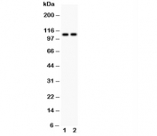Western blot testing of ATP2A1 antibody and Lane 1:  rat skeletal muscle;  2: mouse skeletal muscle;  Predicted size: 110KD;  Observed size: 110KD
