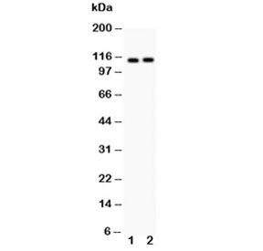 Western blot testing of ATP2A2 antibody and Lane 1: rat skeletal muscle; 2: mouse skeletal muscle; Predicted size: 115KD; Observed size: 115KD