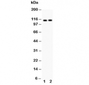 Western blot testing of ATP2A2 antibody and Lane 1:  rat skeletal muscle;  2: mouse skeletal muscle;  Expected molecular weight ~115 kDa.