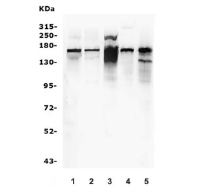 Western blot testing of 1) human SKO-V-3, 2) human SGC-7901, 3) human Jurkat, 4) rat kidney and 5) mouse NIH 3T3 lysate. Predicted molecular weight ~157 kDa.