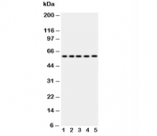 Western blot testing of Occludin antibody and Lane 1:  SW620;  2: COLO320;  3: A549;  4: 293T;  5: U87. Predicted molecular weight ~59 kDa.