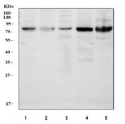 Western blot analysis using PKC delta antibody. Lane 1: human RT-4 cell lysates; Lane 2: human MCF7 cell lysates; Lane 3: human Caco-2 cell lysates; Lane 4: mouse small intestine tissue lysates; Lane 5: mouse ovary tissue lysates. The predicted molecular weight of Protein kinase C delta is ~78 kDa.
