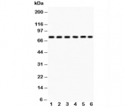Western blot testing of PKC delta antibody and Lane 1:  HeLa;  2: SMMC-7721;  3: U87;  4: Jurkat;  5: CEM;  6: A549;  Predicted size: 77KD;  Observed size: 77KD