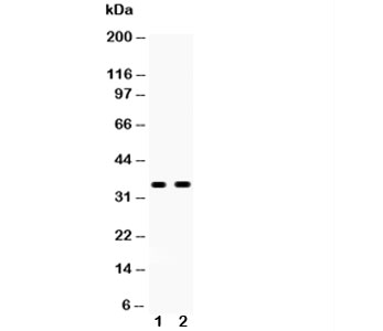 Western blot testing of FRZB antibody and Lane 1: U87; 2: PANC; Predicted size: 36KD; Observed size: 36KD