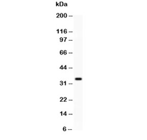 Western blot testing of HGF antibody and NIH3T3 lysate. Predicted molecular weight: 76-91 kDa (precursor), 54-64 kDa (alpha chain), 31-34 kDa (beta chain).