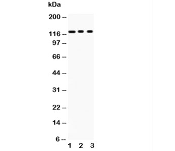 Western blot testing of PLD1 antibody and Lane 1: mouse heart; 2: 22RV1; 3: HeLa; Predicted size: 124KD; Observed size: 124KD