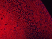 Immunofluorescent staining of FFPE rat brain tissue with EAAT2 antibody (red) and DAPI nuclear stain (blue). HIER: steam section in pH8 EDTA for 20 min.