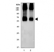 Western blot testing of 1) rat brain and 2) mouse brain tissue lysate with EAAT2 antibody. Predicted molecular weight ~62 kDa.