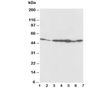 Western blot testing of alpha 2a Adrenergic Receptor antibody and Lane 1: rat testis; 2: rat brain; 3: MCF-7; 4: MM453; 5: SMMC-7721; 6: HeLa; 7: COLO320 cell lysate