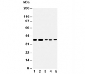 Western blot testing of Angiopoietin 2 antibody and Lane 1:  Recombinant human ANGPT2 protein 10ng;  2: 5ng;  3: 2.5ng