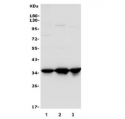 Western blot testing of 1) human HeLa, 2) human K562 and 3) monkey COS-7 cell lysate with Annexin A1 antibody. Predicted molecular weight ~38 kDa.