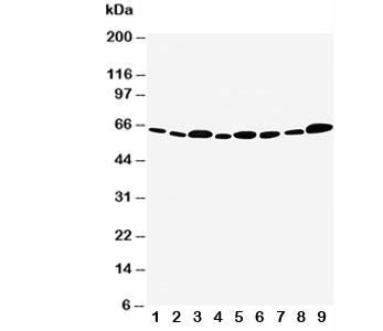 Western blot testing of Apoptosis Inhibitor 5 antibody and Lane 1:  rat heart;  2: rat brain;  3: rat testis;  4: rat placenta;  5: human MCF-7;  6: human HeLa;  7: human CEM;  8: human SMMC-7721;  9: human COLO320 cell lysate. Predicted molecular weight ~59 kDa.