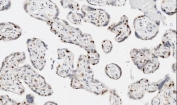 Western blot testing of Apoptosis Inhibitor 5 antibody and Lane 1:  rat heart;  2: rat brain;  3: rat testis;  4: rat placenta;  5: MCF-7;  6: HeLa;  7: CEM;  8: SMMC-7721;  9: COLO320 cell lysate