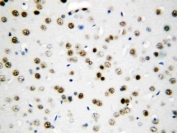 IHC staining of FFPE rat brain tissue with Apoptosis inhibitor 5 antibody. HIER: boil tissue sections in pH8 EDTA for 20 min and allow to cool before testing.