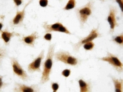 ICC staining of human HeLa cells with Apoptosis inhibitor 5 antibody.
